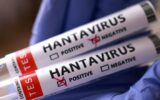 Hantavirüs’de son durum: Birçok ülke vatandaşlarını tahliye için bekliyor